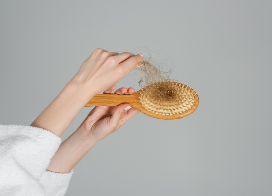 Brush with excess hair due to PCOS hair loss